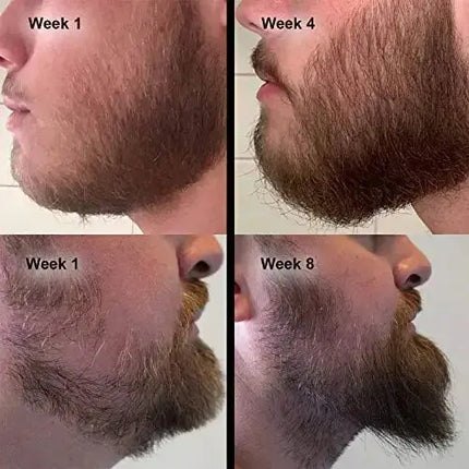 Chebe Beard Growth Oil Serum Fast Growing hair Mustache Facial Hair Grooming for Men Thick Long - Premium  from FRANTZDOL STORE  - Just $15.99! Shop now at FRANTZDOL STORE 